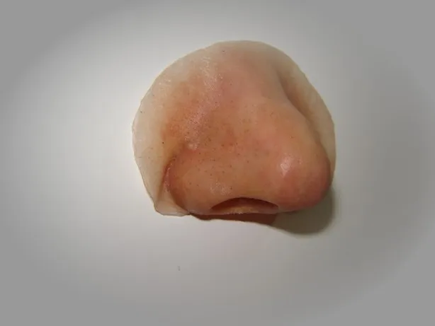 Prótesis nasal